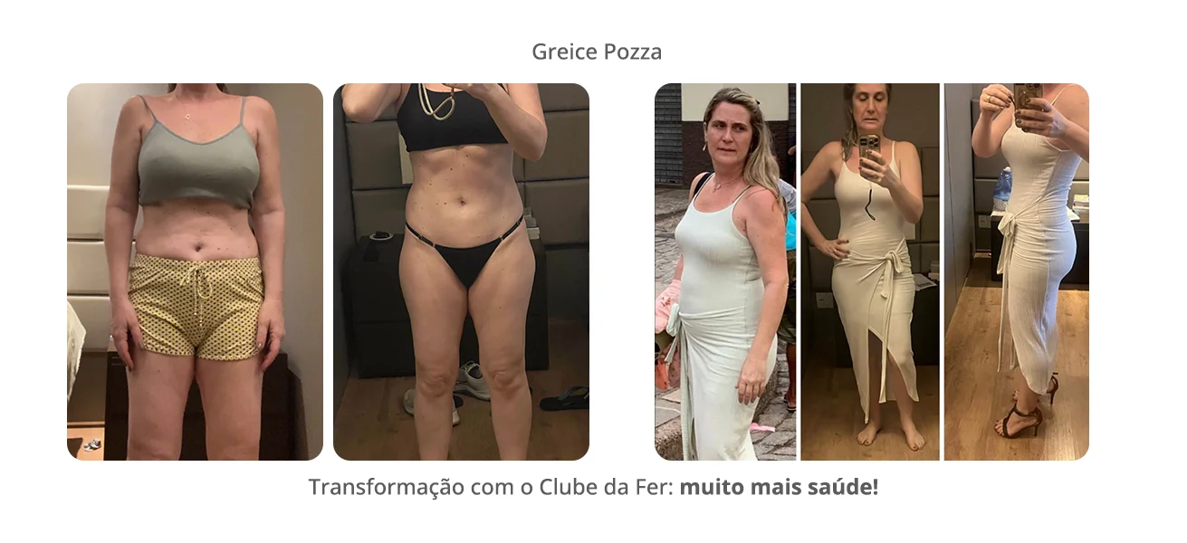 antes e depois - Greice Pozza v2