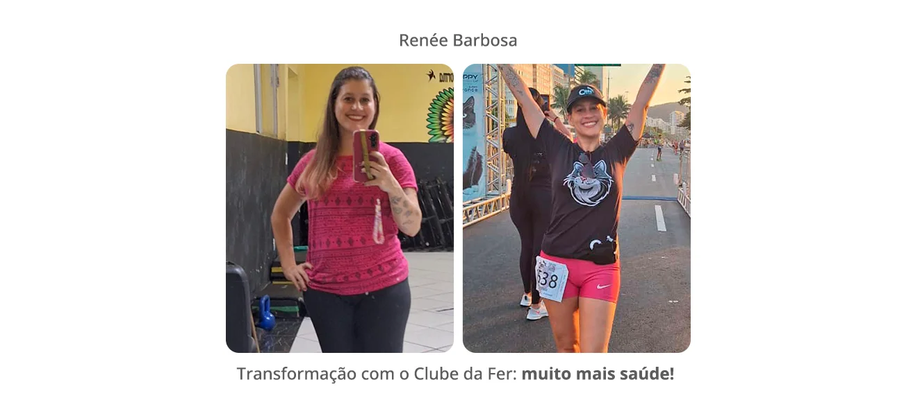 antes e depois renee v2